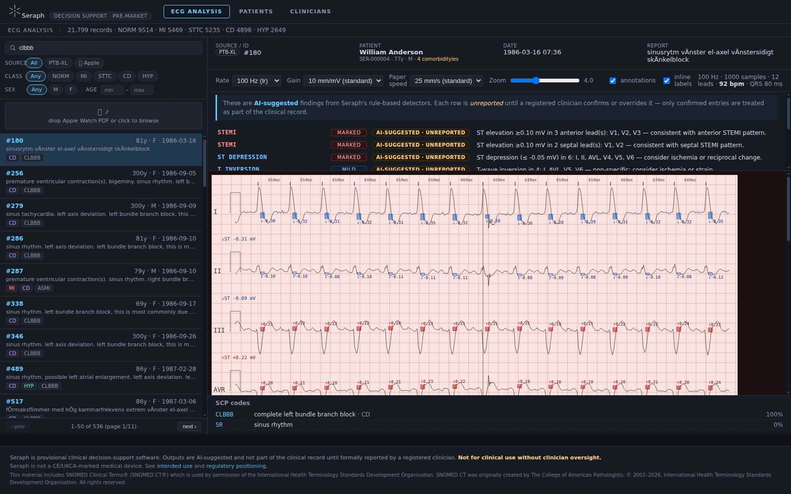 Seraph ECG analysis interface showing suggested findings beside a 12-lead ECG trace